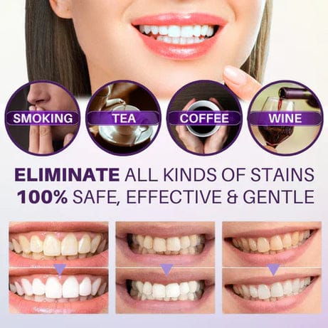🦷✨ Hismile V34 💜 Teeth Brightening Serum – 30ml Get a whiter, brighter smile instantly with color-correcting magic!