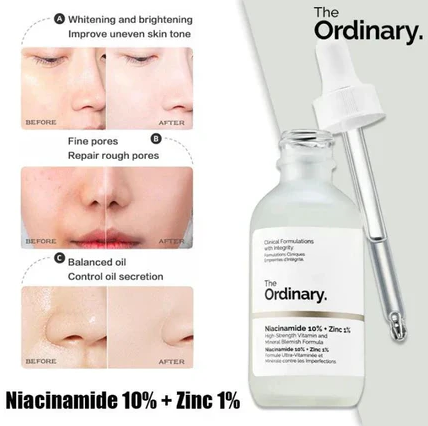 The Ordinary Niacinamide 10% + Zinc 1 % – 30ml |oil Control, Pore Minimizing & Blemish Solution Serum